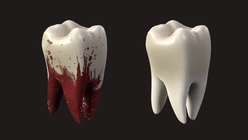 Tooth